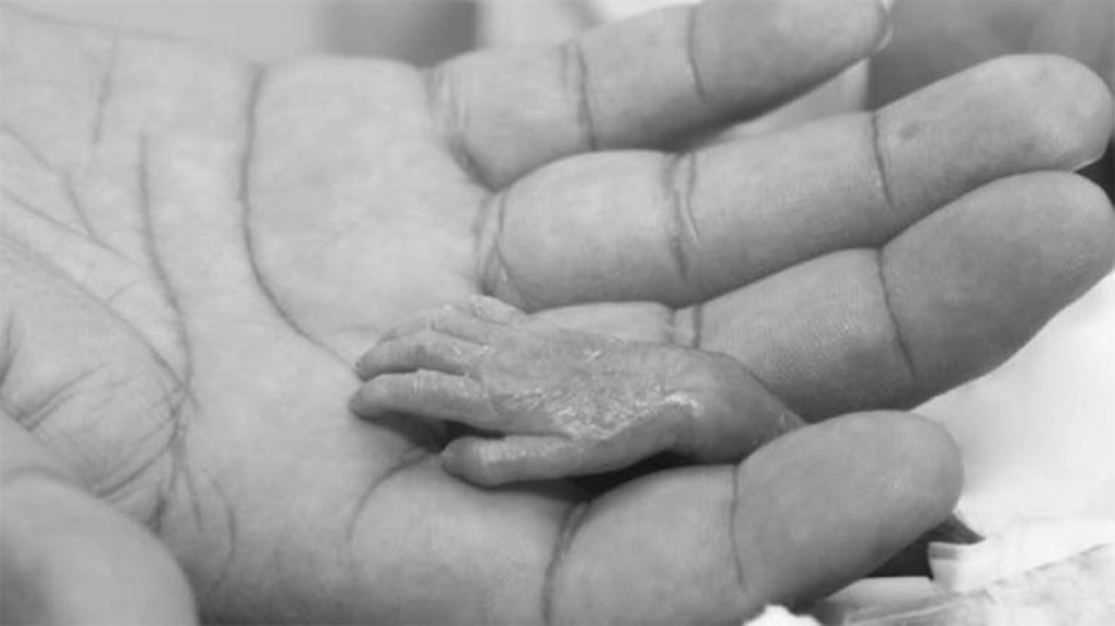 Decesul fetal