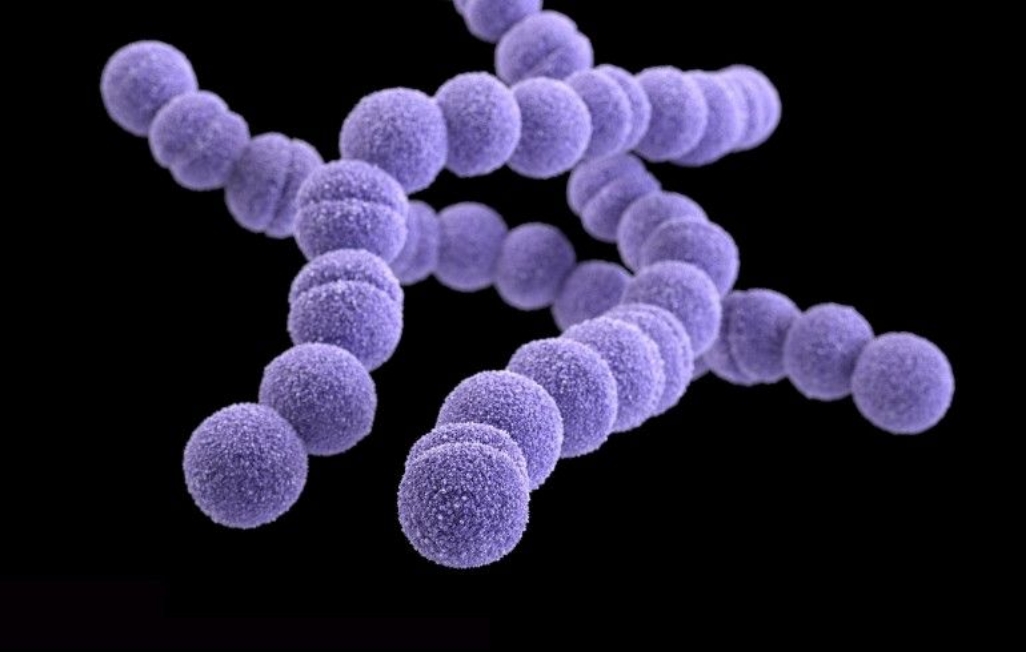 Infecția membranelor și a lichidului amniotic