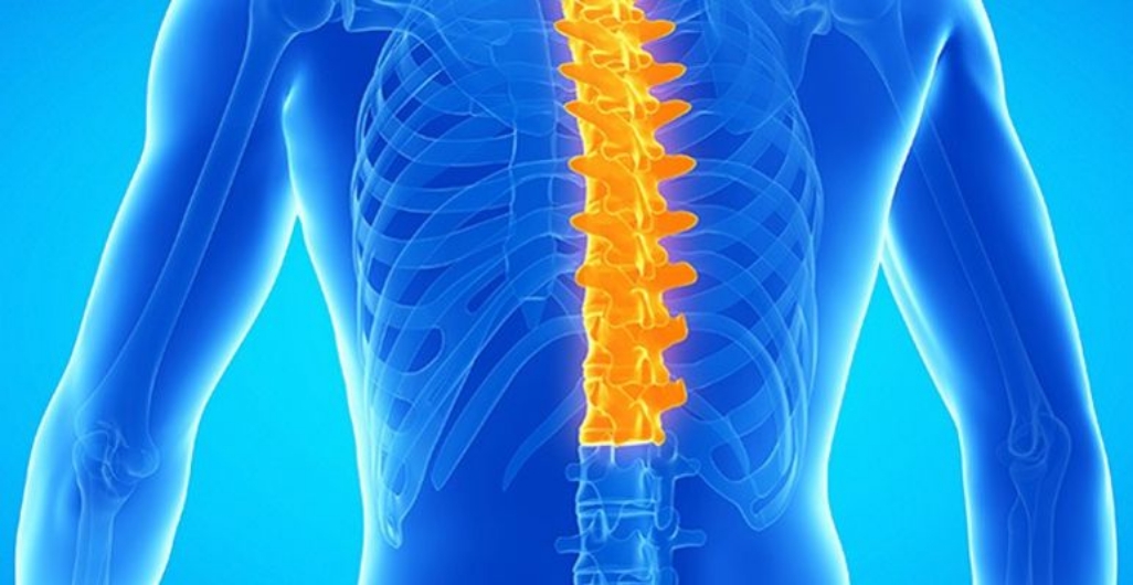 Spina Bifida