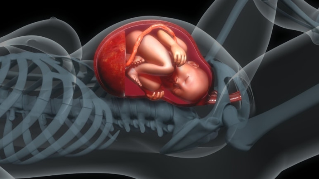 Placenta Accreta: Ghid complet