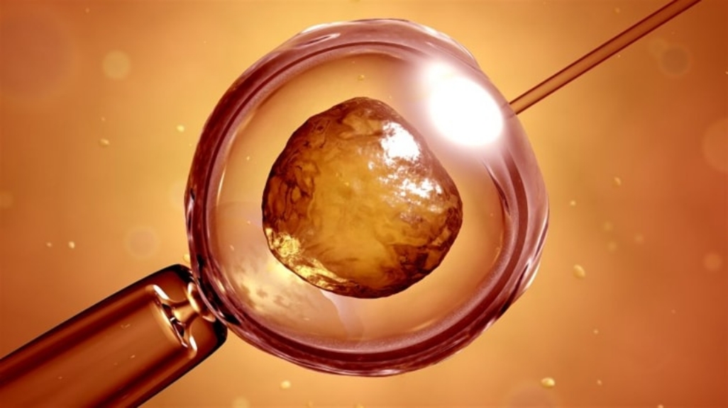 Fertilizarea In Vitro